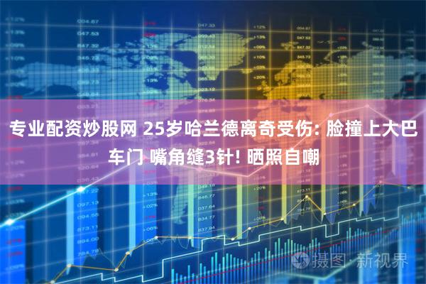 专业配资炒股网 25岁哈兰德离奇受伤: 脸撞上大巴车门 嘴角缝3针! 晒照自嘲